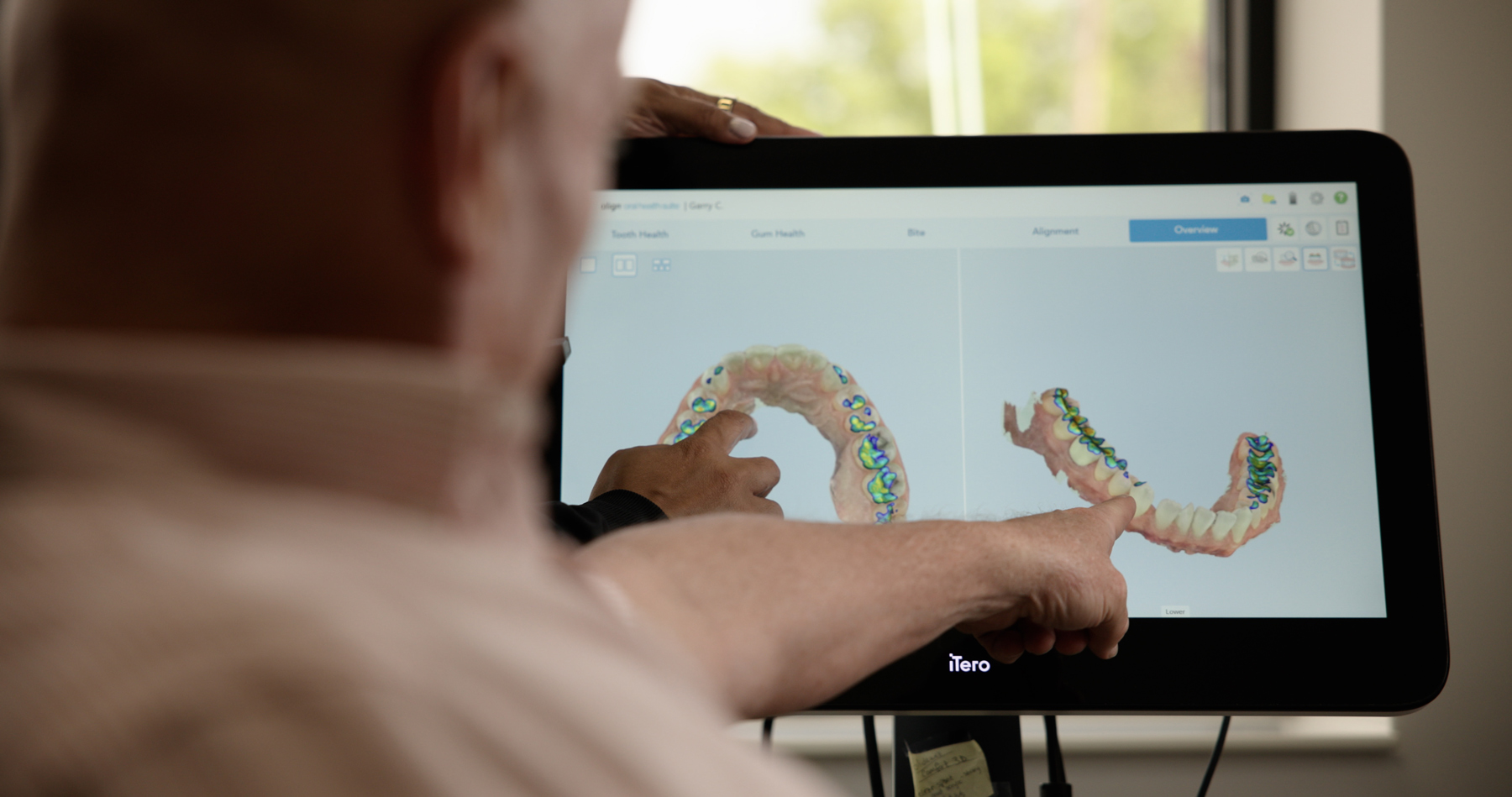 Dentist reviewing an iTero digital scan with a patient